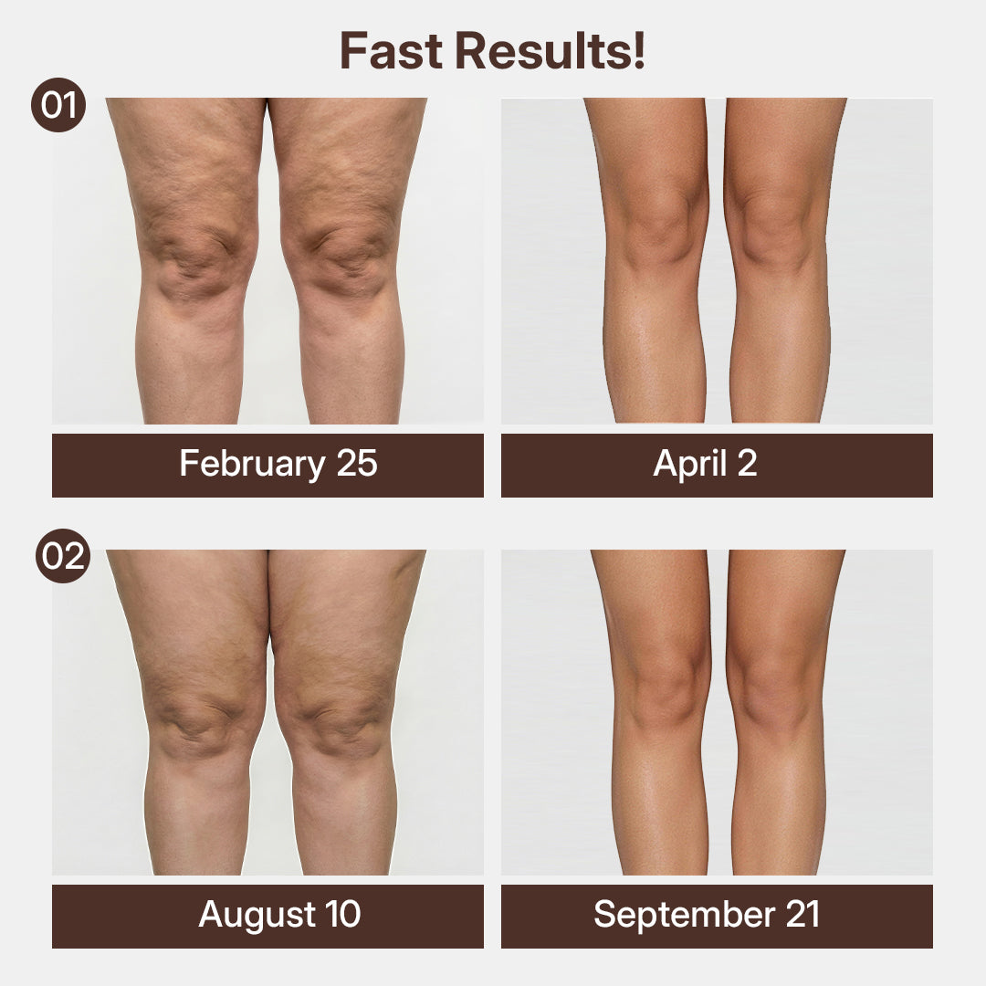 Silix™ 3D Compression Knee Sleeves –Say Goodbye to Saggy, Uneven-Looking Legs
