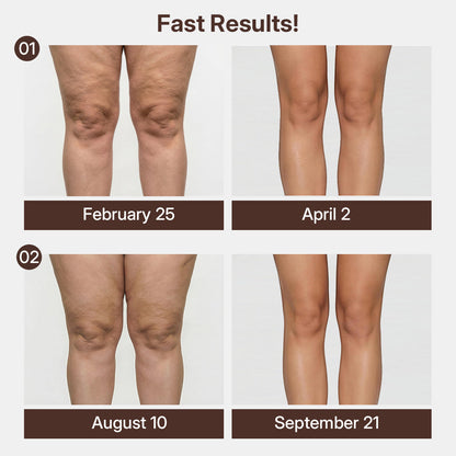 Silix™ 3D Compression Knee Sleeves –Say Goodbye to Saggy, Uneven-Looking Legs